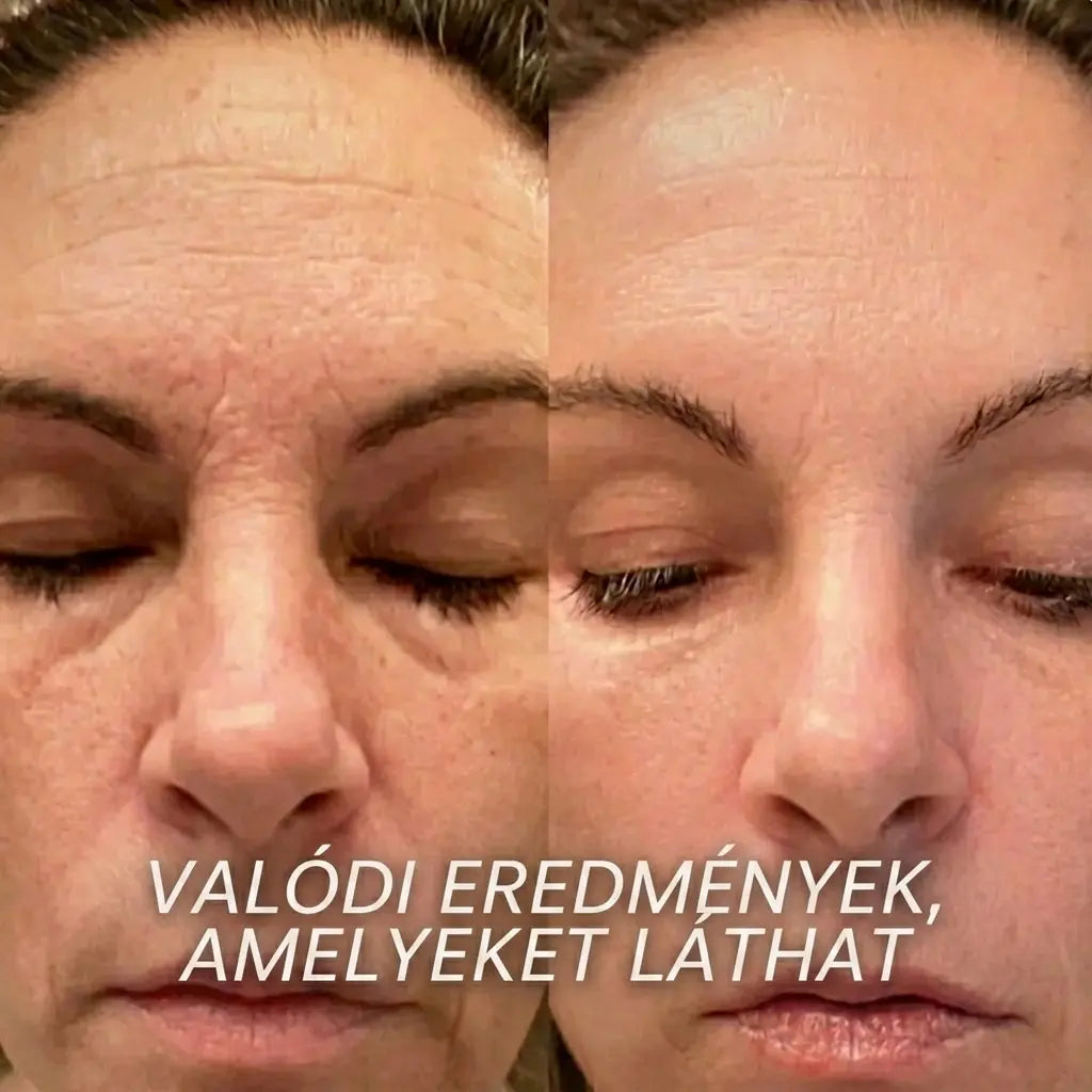 KALEA Kollagen PDRN Bőrfeltöltő Stift