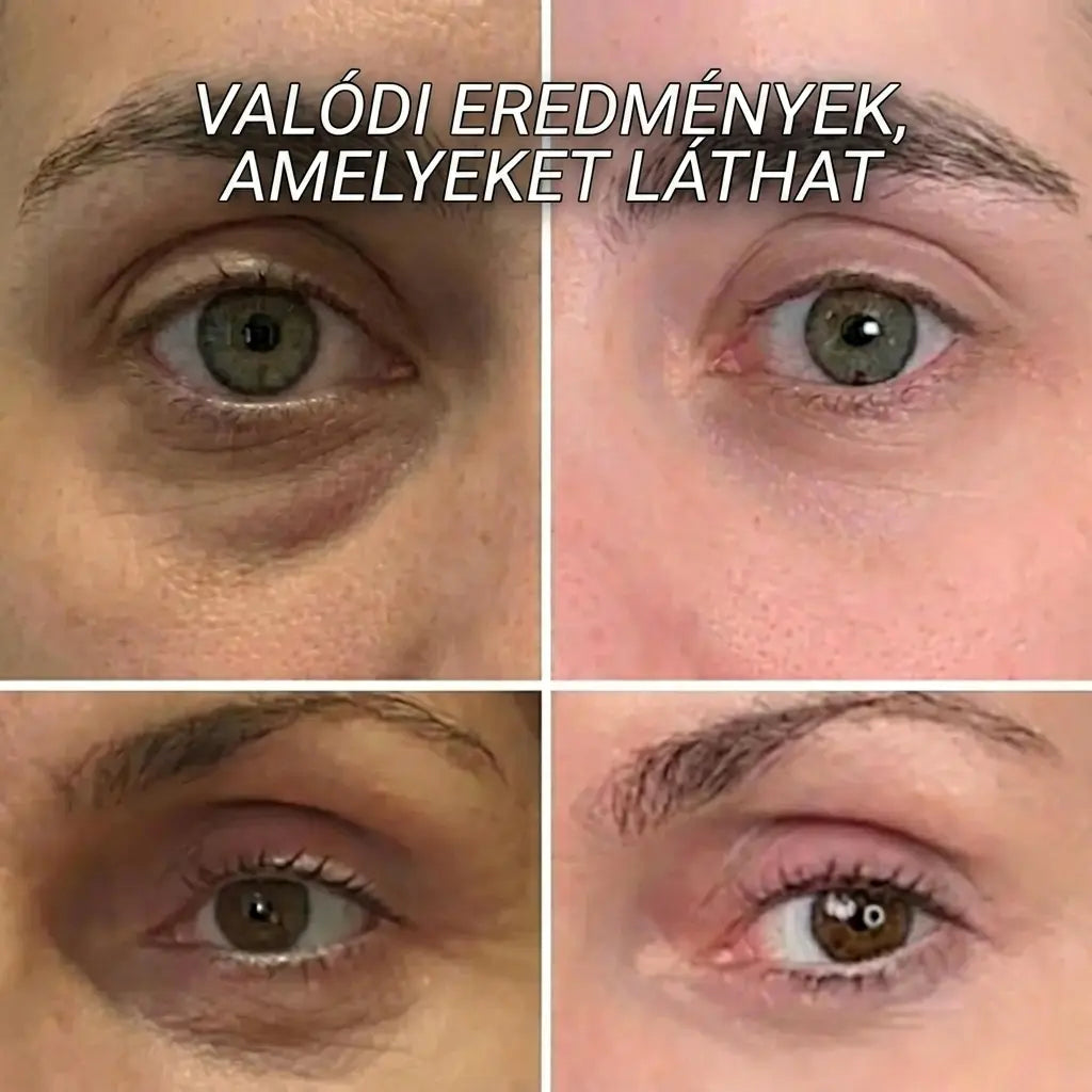 KALEA Kollagen PDRN Bőrfeltöltő Stift
